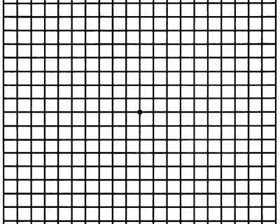 Image of an Amsler grid, which patients use to monitor progression of AMD
