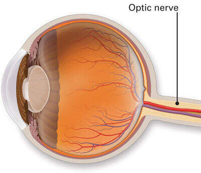 Diagram of Optic nerve in the eye