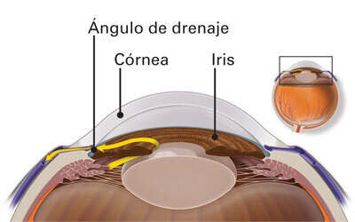 ángulo de drenaje en un ojo sano - glaucoma