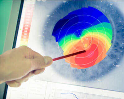 Sample image of what a corneal topography scan might look like.