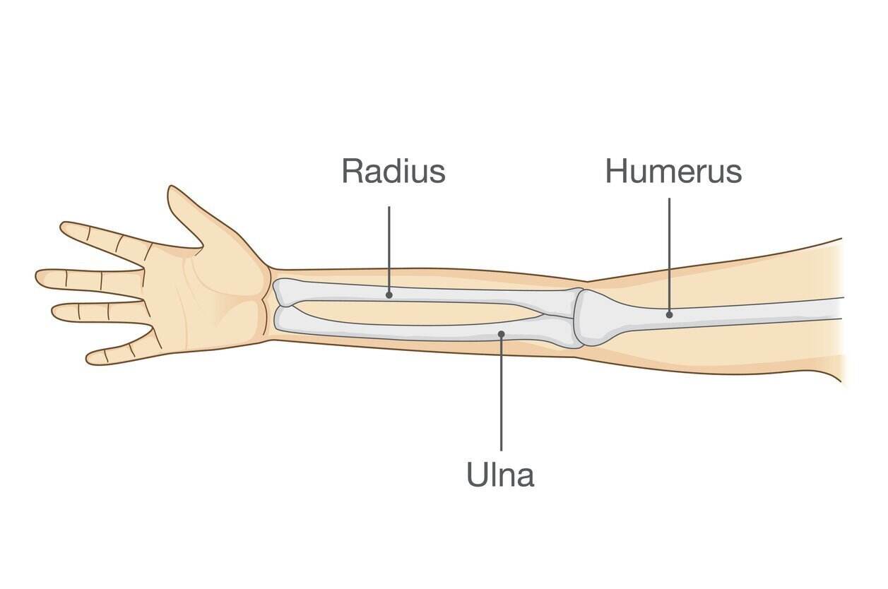 Broken Arm Symptoms