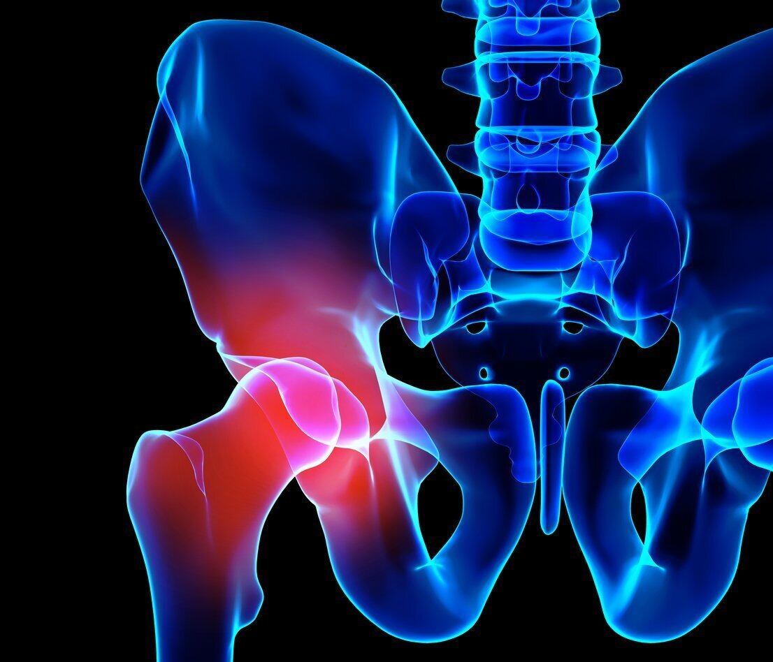 Get Relief for Hip Pain at Any Age - Comprehensive Orthopaedics