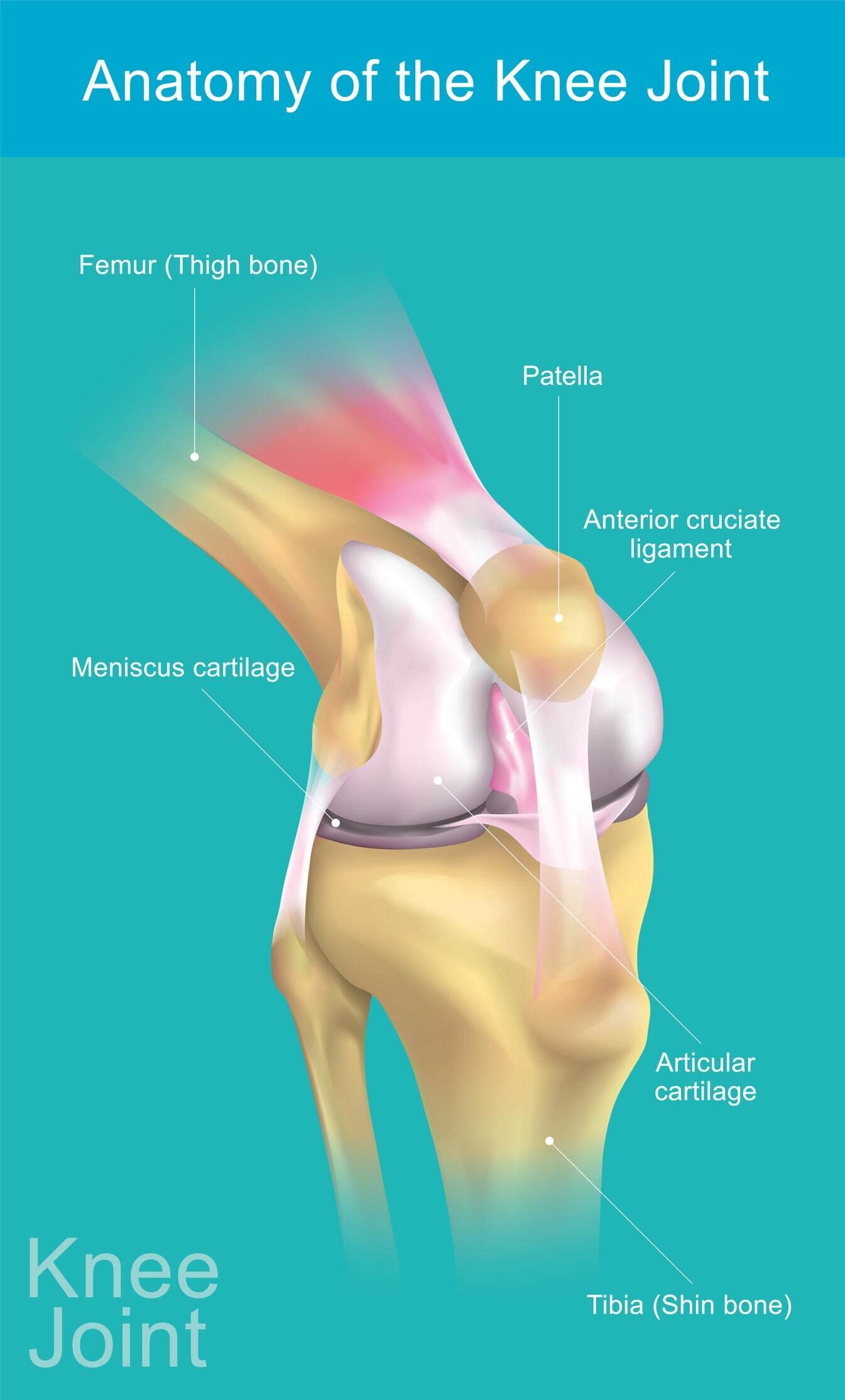 is a lateral or medial meniscus tear worse)