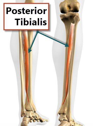 Shin Splints: Causes, Symptoms & Treatment