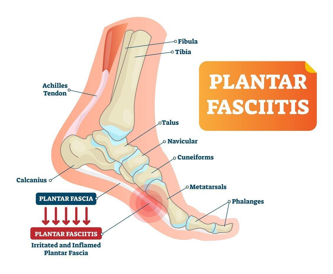 What causes foot and ankle pain and when to see a podiatrist-totobed.com.vn