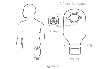 An ostomy pouch or bag that collects stool. The pouch is a 2-piece appliance that consists of water and a clip.