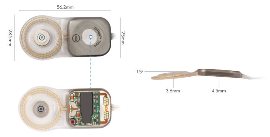 Cochlear Ab Gold Cochlear Implants Analog