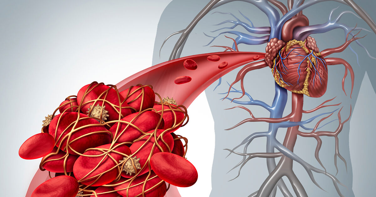 Blood clots passing : what's normal and what's not? PIC INCLUDED