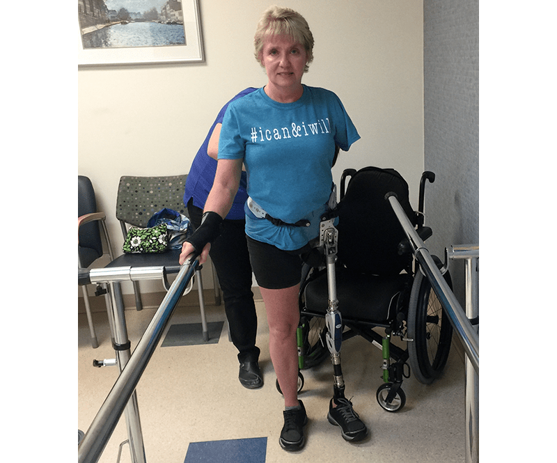 Laurie in rehab using new prostheses