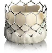 TAVR for Aortic Valve Conditions | MT | Billings Clinic