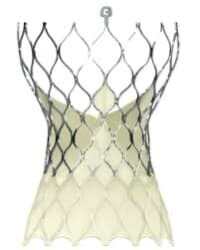 Tav Device TAVR for Aortic Valve Conditions | MT | Billings Clinic