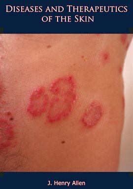 Diseases and Therapeutics of the Skin - free ebook