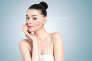 Women showing glowing skin after acne scar treatment