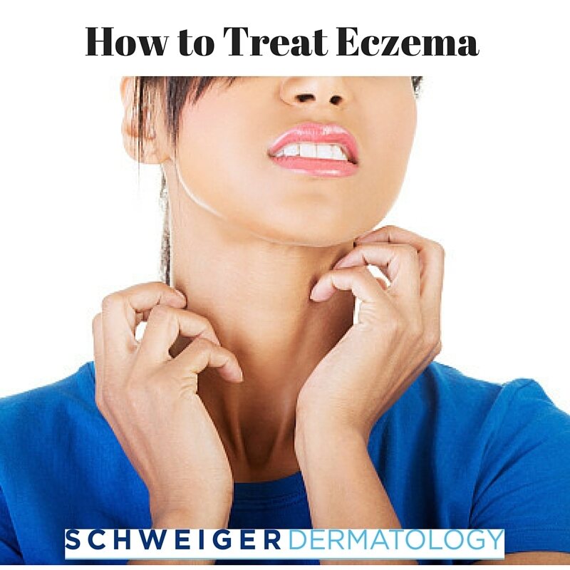 Woman with eczema having itching on her neck.