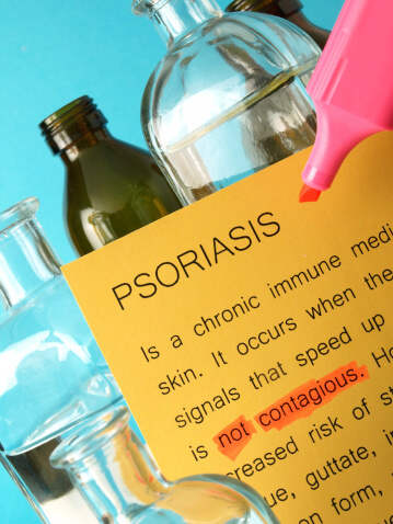 Tips to treat Psoriasis 