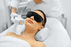 Laser Treatment for scars on the skin