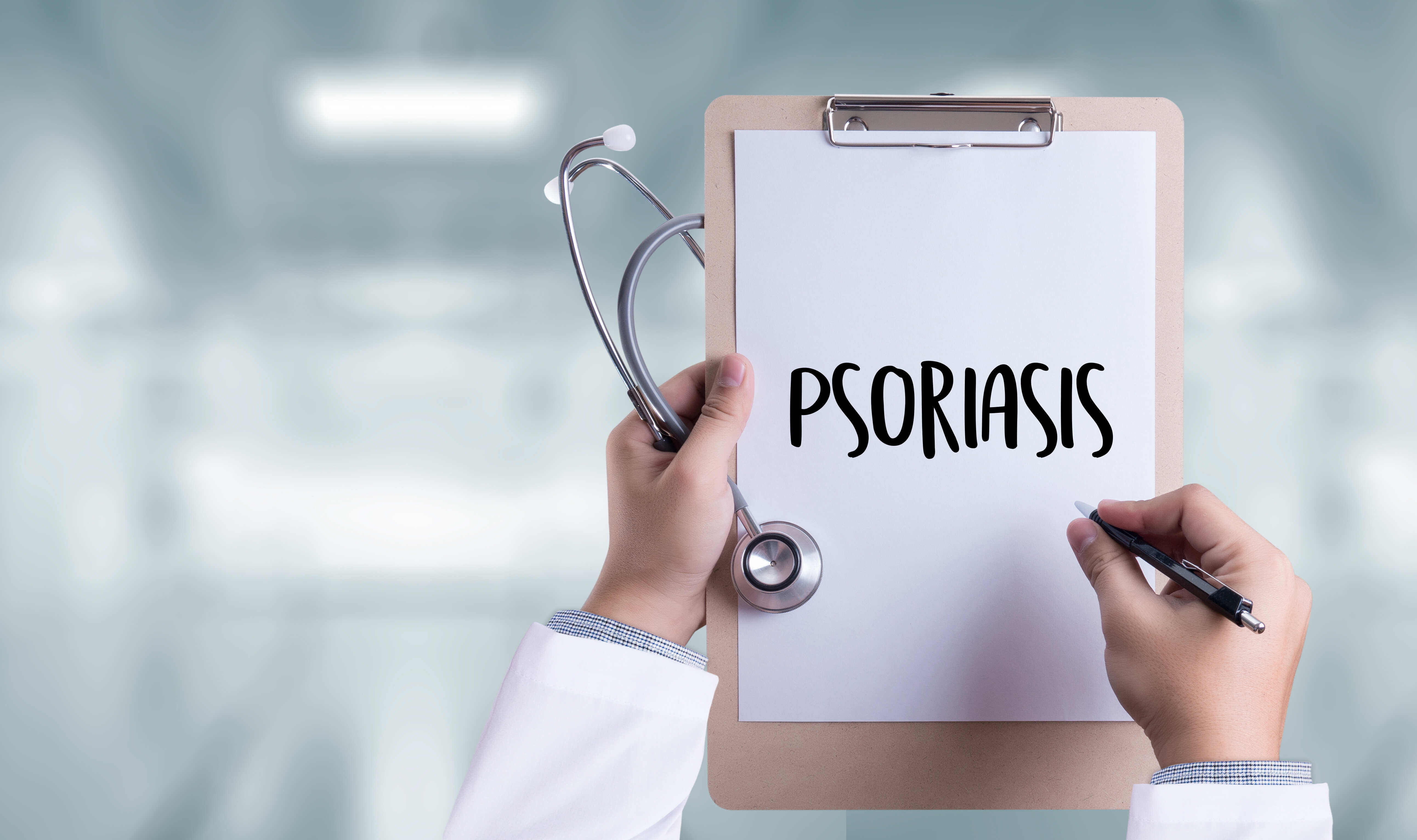 Doctor writing suggestions to prevent against psoriasis
