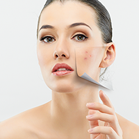 the-3-most-common-types-of-acne-and-how-to-treat-each