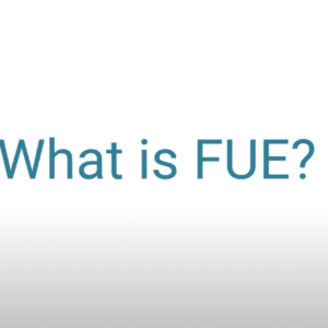 What is FUE?