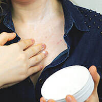 the-10-best-anti-itch-creams-according-to-dermatologists