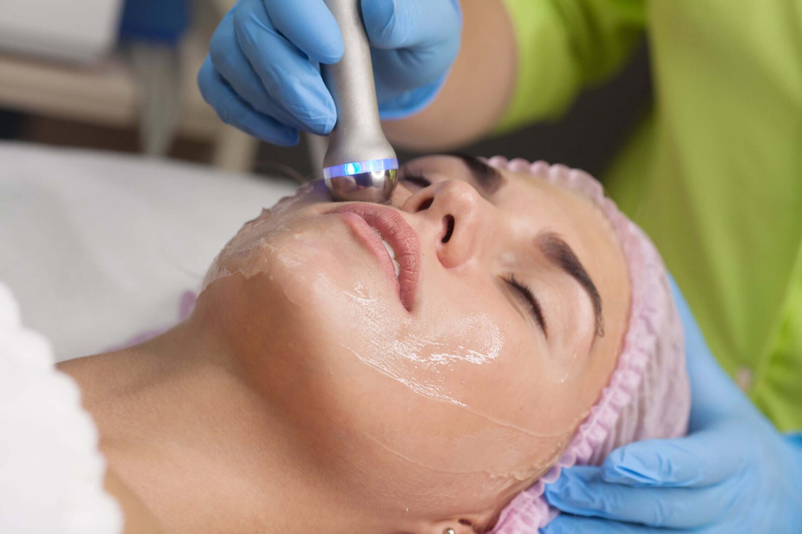 Laser Treatments for Fine Lines and Wrinkles