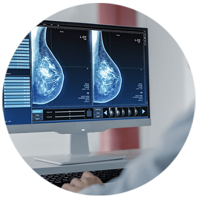 Mammogram scan on a computer